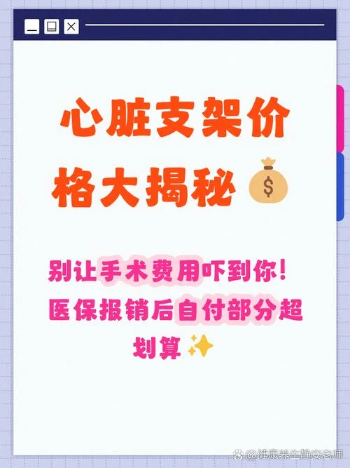 换一个心脏需要多少钱_1
