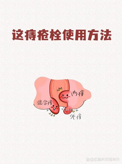 普济痔疮栓多少钱_2