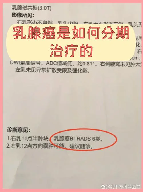 乳腺癌能治好要多少钱_1