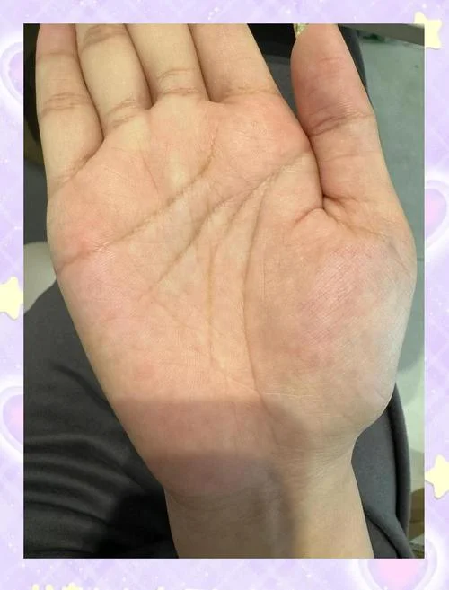 婚姻线上有元宝纹手相-婚像显元宝纹