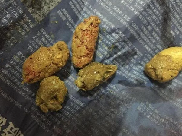 梦见自己吃了一口屎_2