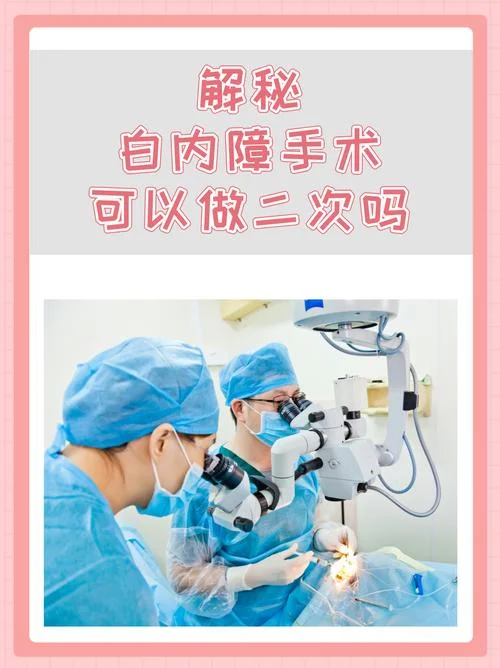 白内障手术原理的书_1
