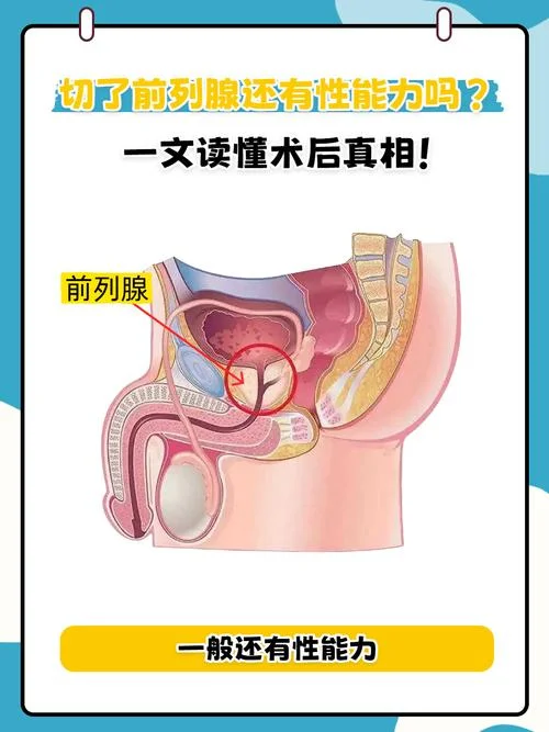 前列腺炎手术是割什么_1