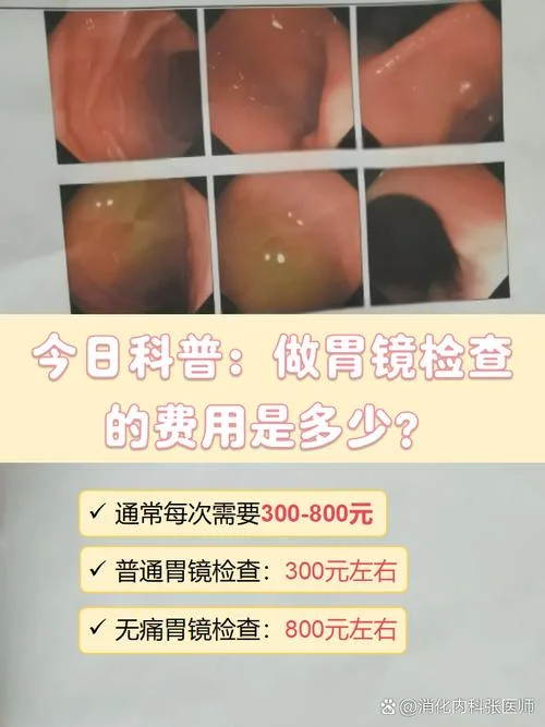 胃肠镜多少钱_1