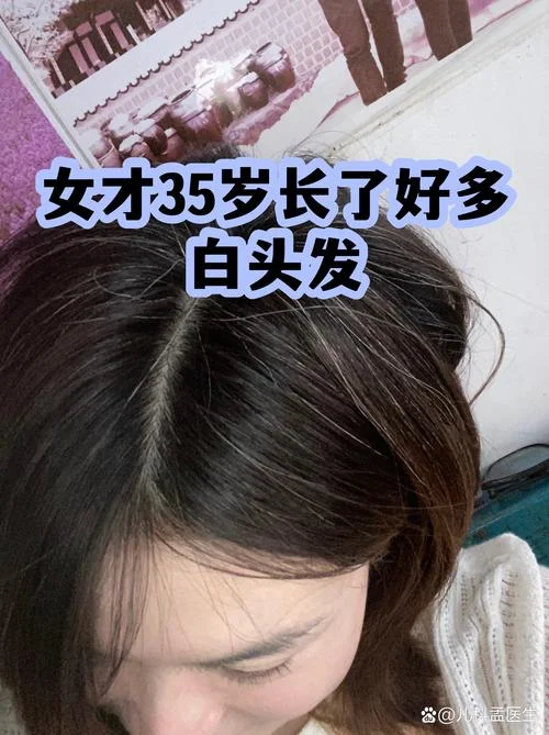 梦到长白头发了是什么预兆_1