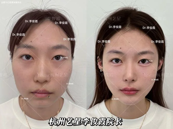 整容师去哪里学_2