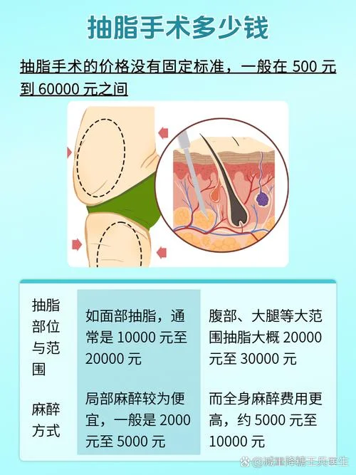 腰腹部抽脂多少钱_1