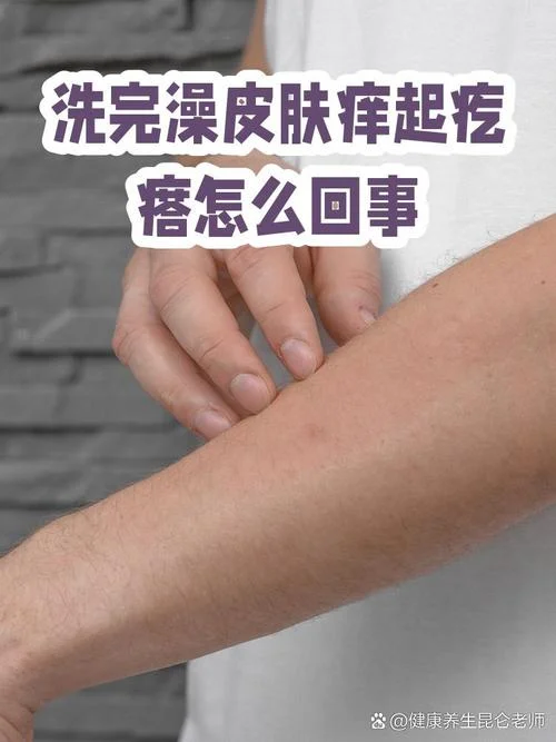 皮肤刺痒怎么办_1