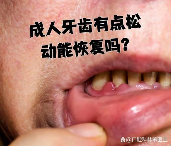 梦见下面牙松动_1