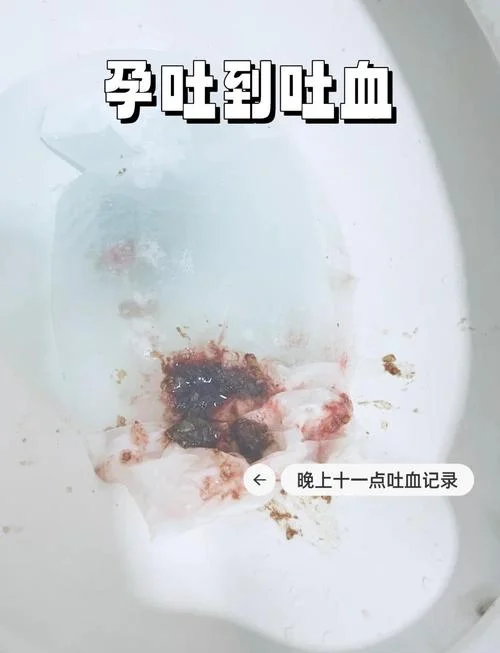 梦见自己吐了好多东西_2