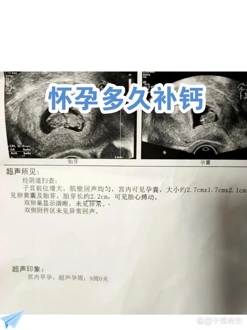 孕几月开始补钙-孕早期开始补钙