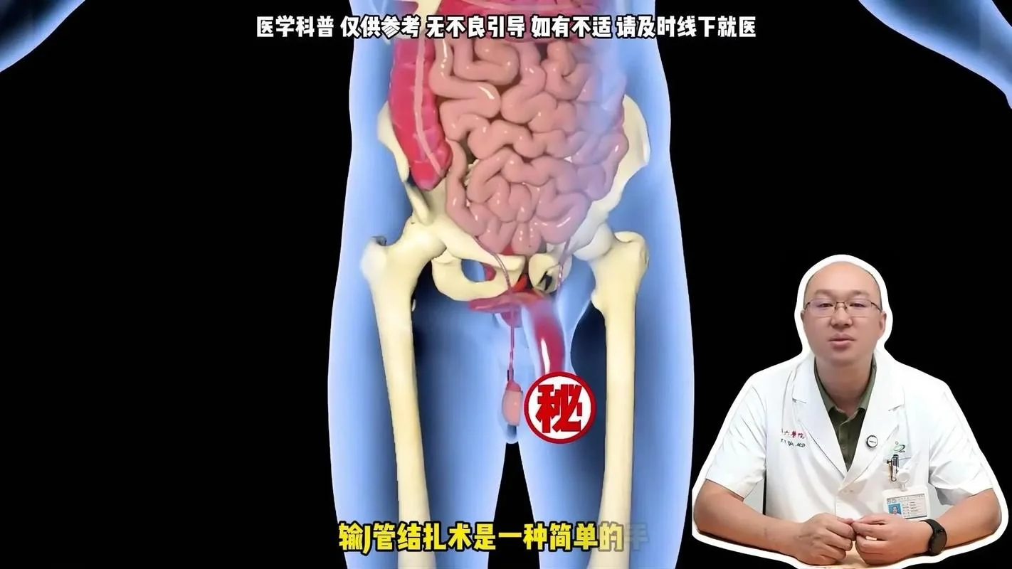 男科手术_2