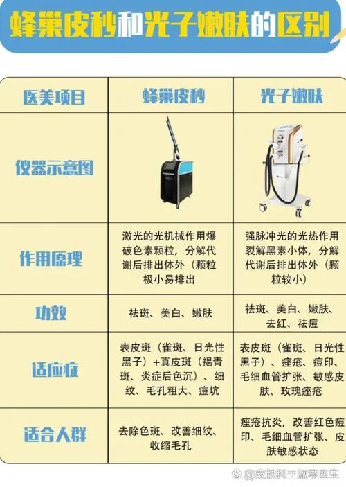 做激光祛斑多少钱一次-激光祛斑单次费用