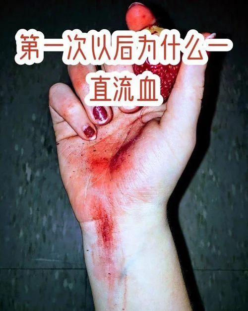 梦见自己流血了咋回事_2