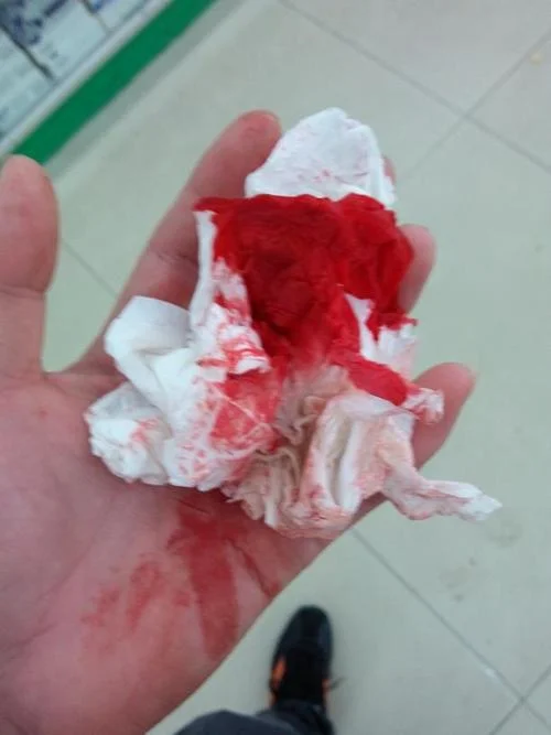 梦见打架流了好多血什么预兆_2
