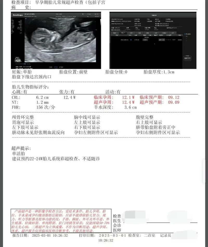 孕检nt是什么检查多少钱-孕检NT检查费用