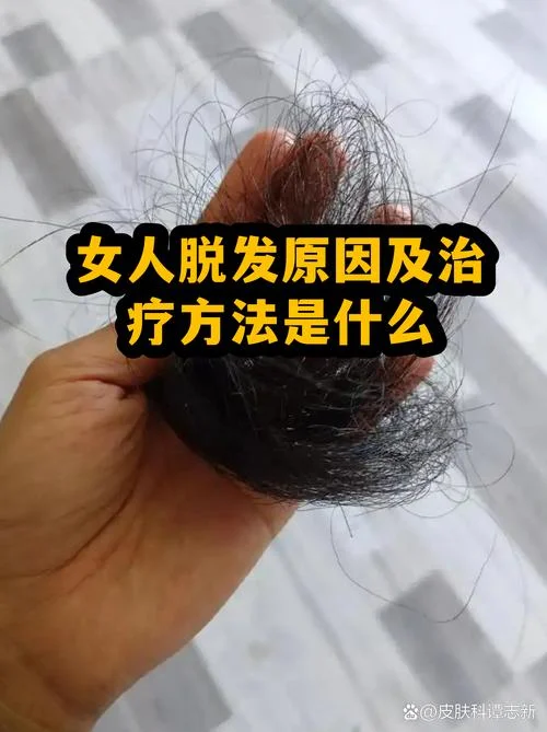 女人梦到头发掉了一把_1