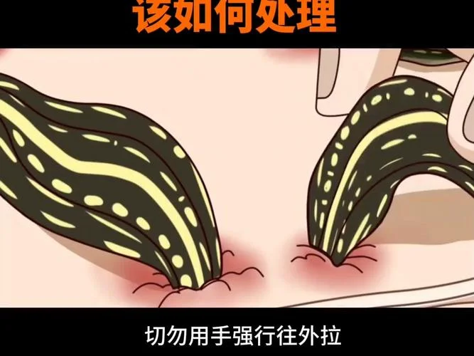 梦见很多蚂蝗吸自己的血是什么意思_1