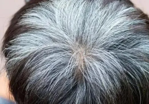 梦见头发白了很多_1