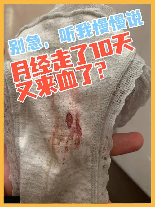 梦见经期流血量很多_1