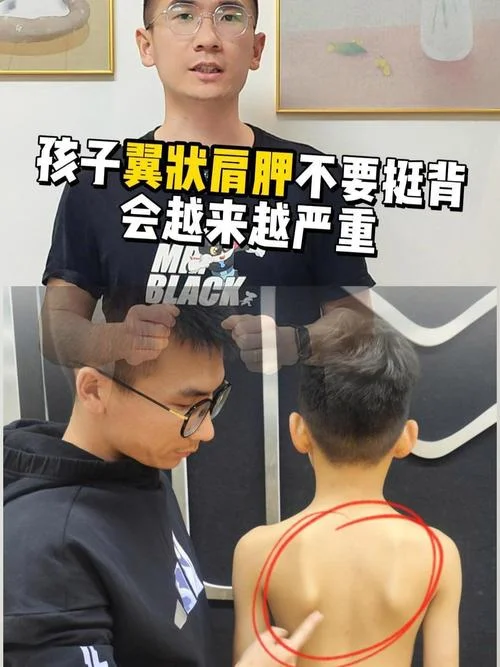 小孩肩胛骨突出怎么办-小孩肩胛骨突出怎么办