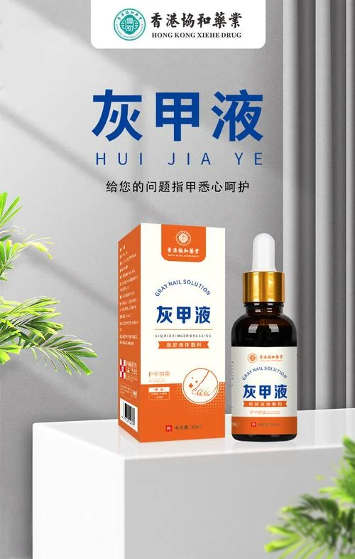 灰指甲买什么药涂_2