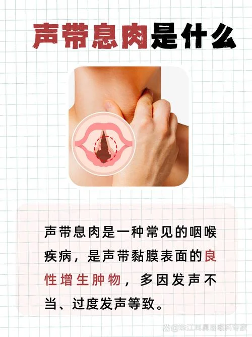 咽喉有息肉怎么办-咽喉息肉怎么办