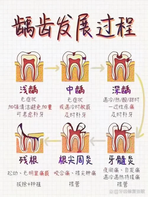 蛀虫的道理10字_1