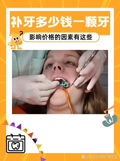 现在补牙齿要多少钱-补牙费用概算