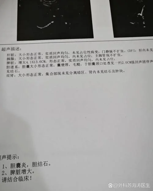 胆囊结石7mm需要多少钱_2