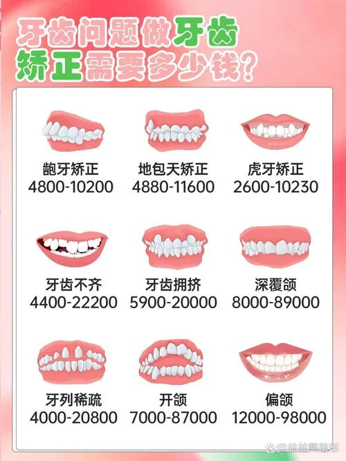 衢州矫正牙齿多少钱_2