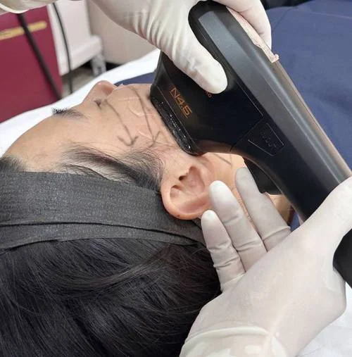 超声刀作用与原理_1