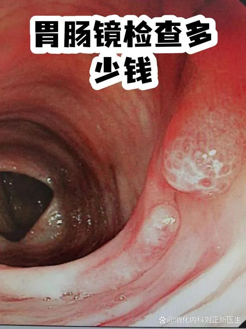 磁控胃镜多少钱上海_2