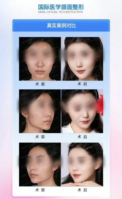 面部轮廓重建_2