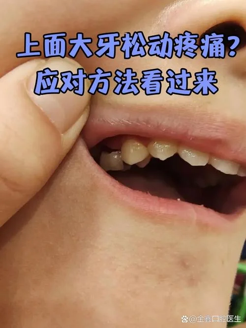 做梦牙齿松动要脱落_1