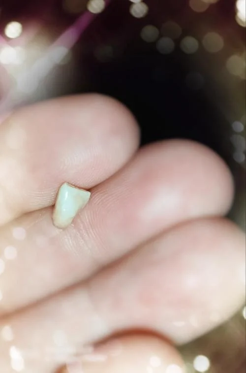 梦见掉牙齿和棺材_1