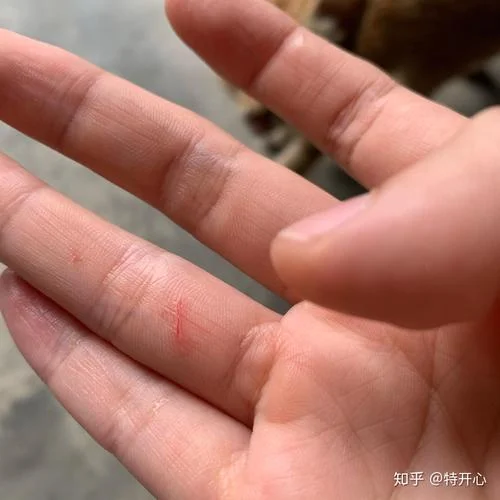 梦见猫咬了自己的手指头_1