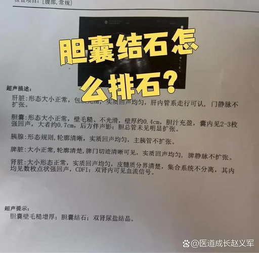 胆结石6毫米怎么办_1