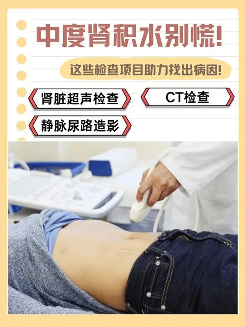 如何查肾积水_1