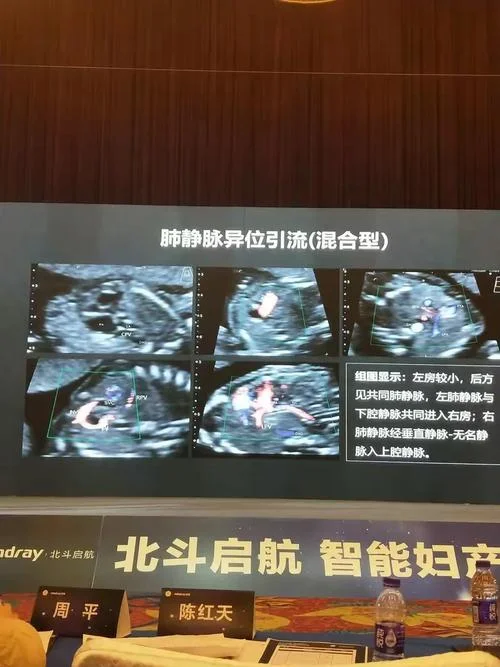 超声主治医师报名条件2018_2