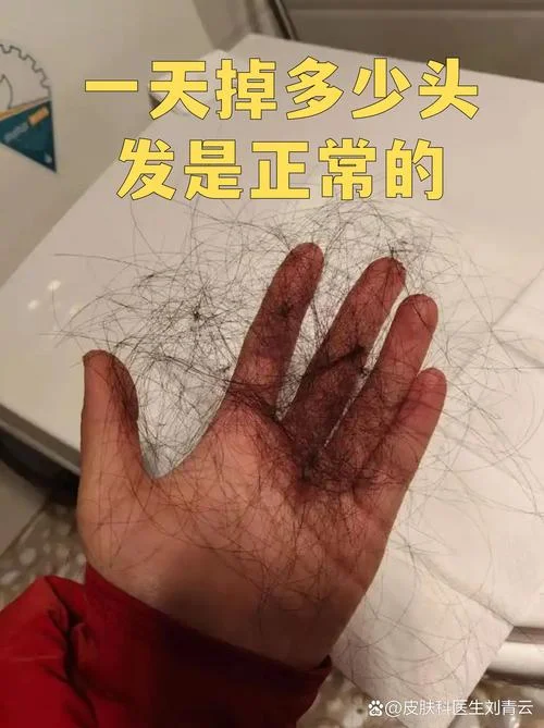 梦见掉很多头发好吗_1