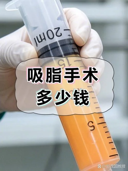 上臂抽脂大约多少钱_1