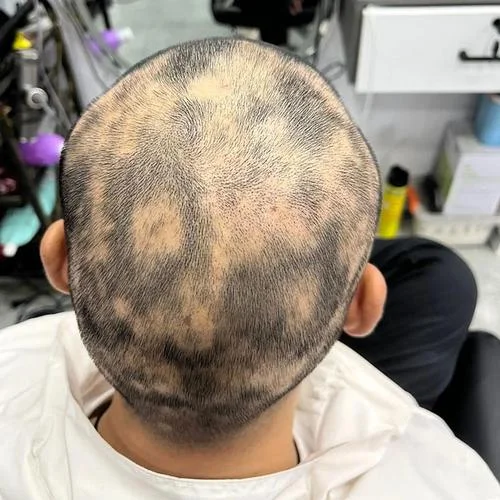 梦见后脑勺头发稀少_1