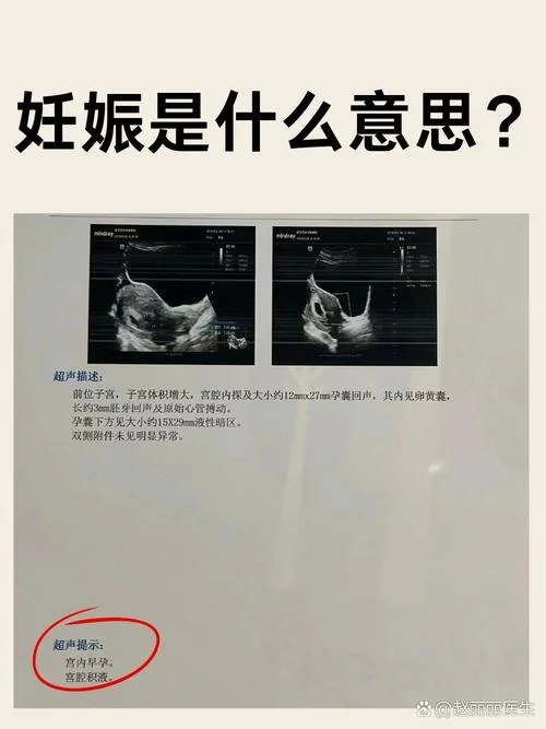 45岁梦见自己怀孕是什么意思_1