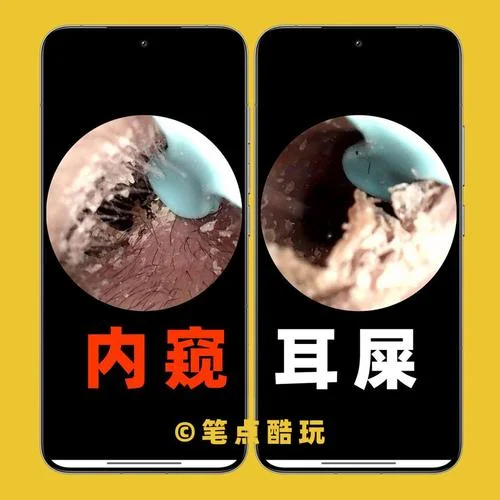 梦到自己掏耳屎_1