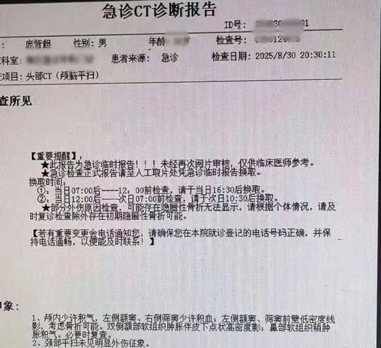 大脑ct检查多少钱_1