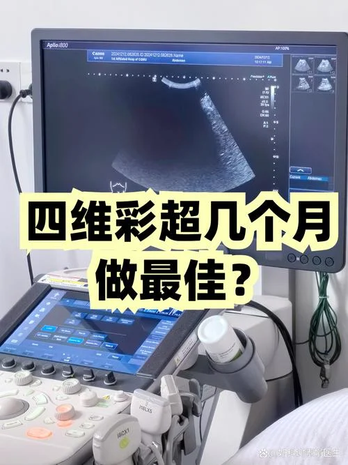 做四维彩超要多少钱一次_1