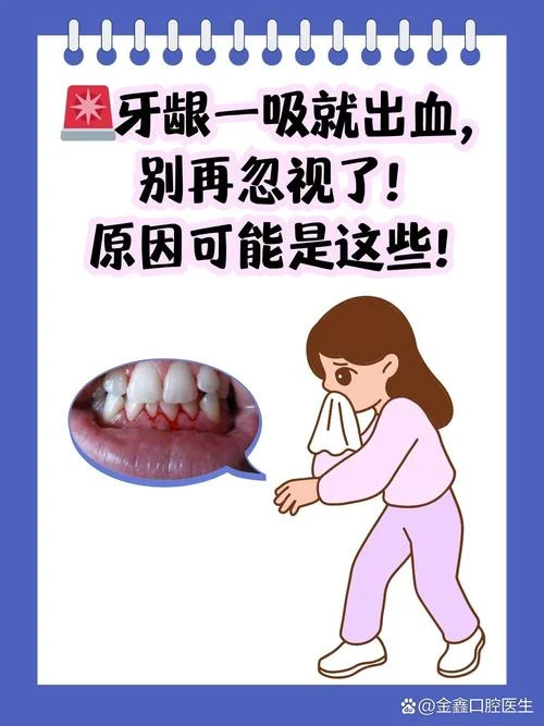 梦见牙掉流了好多血是什么意思_2