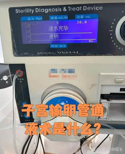 通液大概多少钱_1