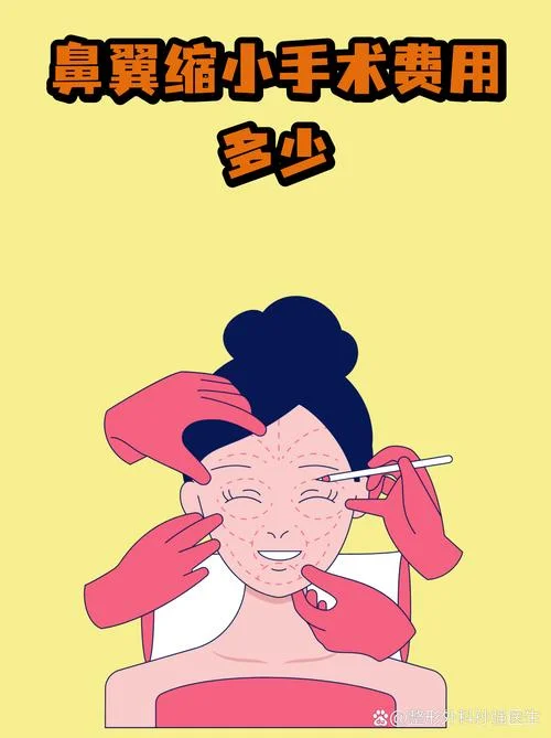 鼻孔缩小术需要多少钱_1